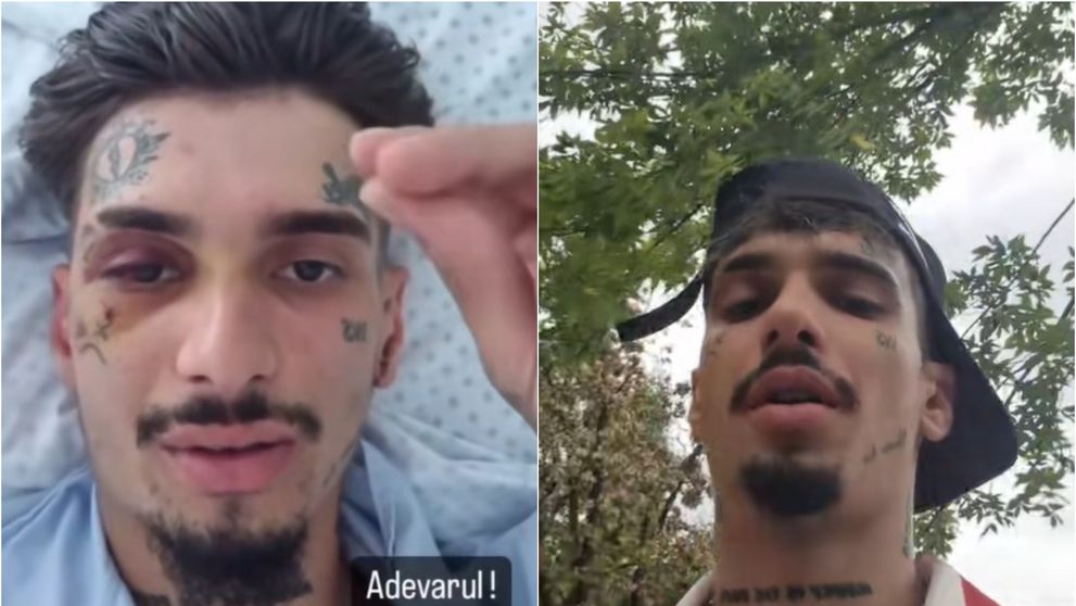 Un celebru influencer din România a intrat în comă, la scurt timp după ce a suferit un AVC. Totul ar fi pornit după ce a fost luat la bătaie anul trecut
