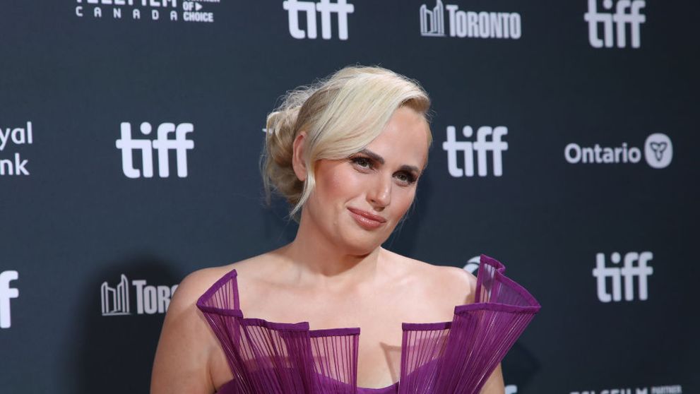 Rebel Wilson a fost supusă unei intervenții chirurgicale de urgență după un accident petrecut pe platourile de filmare ale noului ei film, „Bride Hard”. „Era o baltă de sânge”
