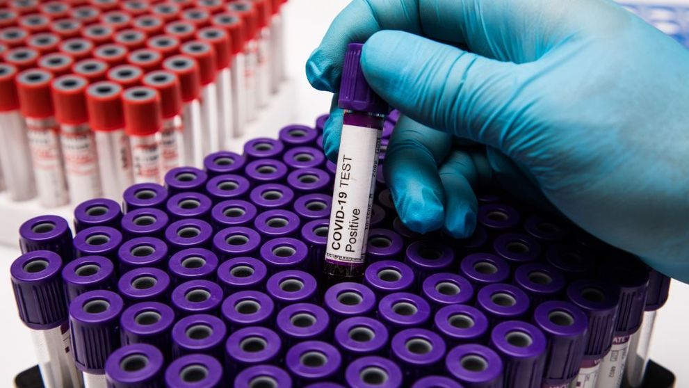 În ce condiții se vor putea testa pentru noul coronavirus bucureștenii care pleacă în Grecia și în alte vacanțe?