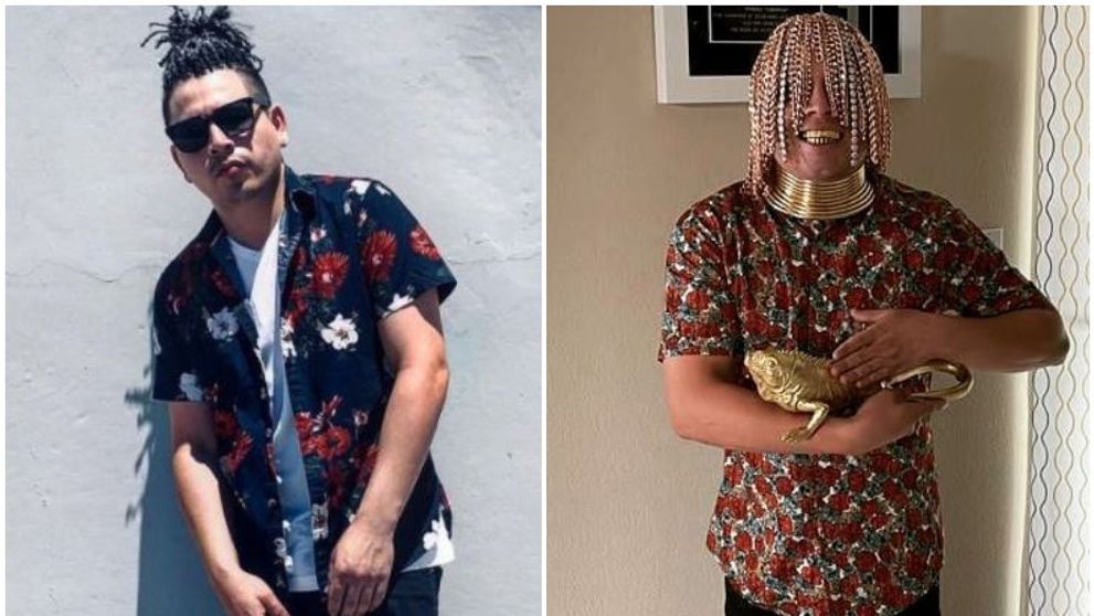 Rapperul Dan Sur și-a făcut implantat cu lanțișoare de aur în loc de păr. „Mi-am dorit să fac ceva diferit”