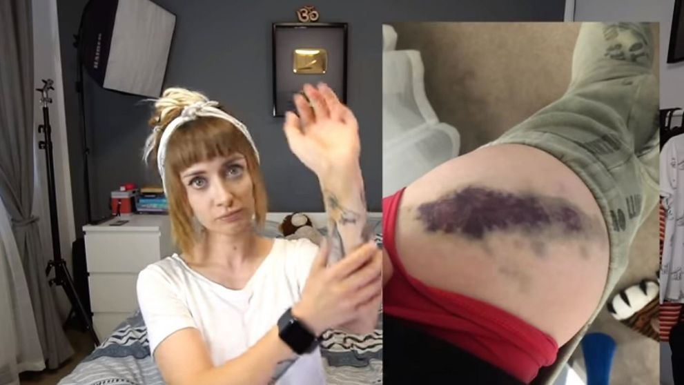 Bianca Adam, alias Tequila, bătută în parcare de un dezvoltator imobiliar. Ce chin a îndurat