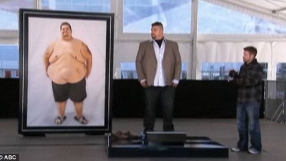 Caz ULUITOR! Un barbat OBEZ<span style=