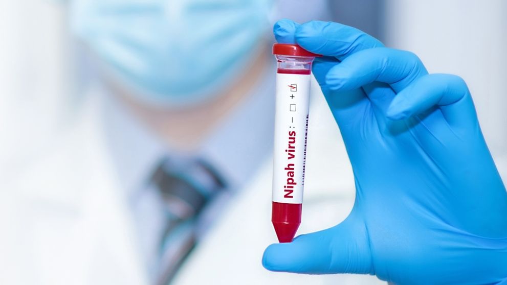 Cum se transmite virusul Nipah și cât de periculos este. Kazahstanul intensifică controlul la frontiere, după ce primele cazuri de infectare s-au înregistrat în India