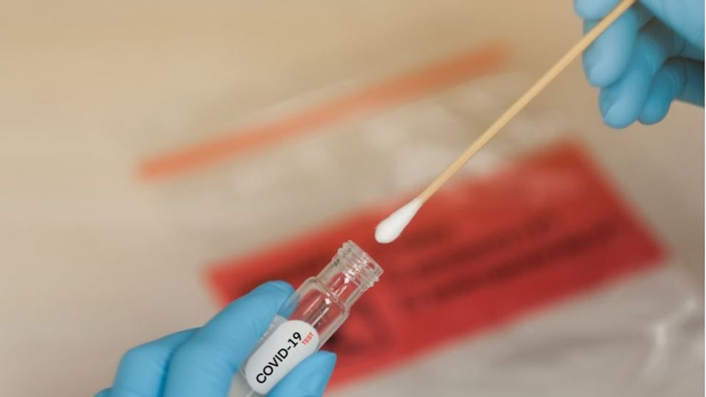 S-a aprobat primul kit de testare pentru Covid-19 ce poate fi folosit acasă și care oferă rezultatul în 30 de minute