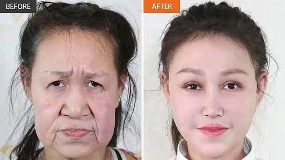 La 15 ani arăta ca la 60. Transformarea uluitoare a adolescentei chineze după ce a fost operată de 10 medici