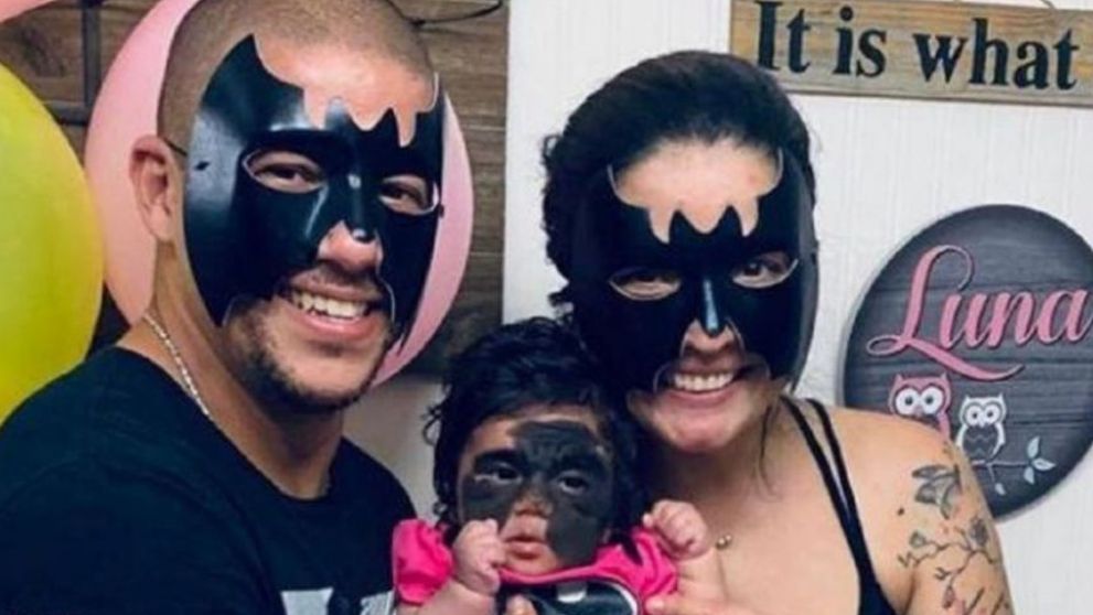Cum arată Fetiţa-Batman la 6 ani, după ce a trecut printr-o nouă operație
