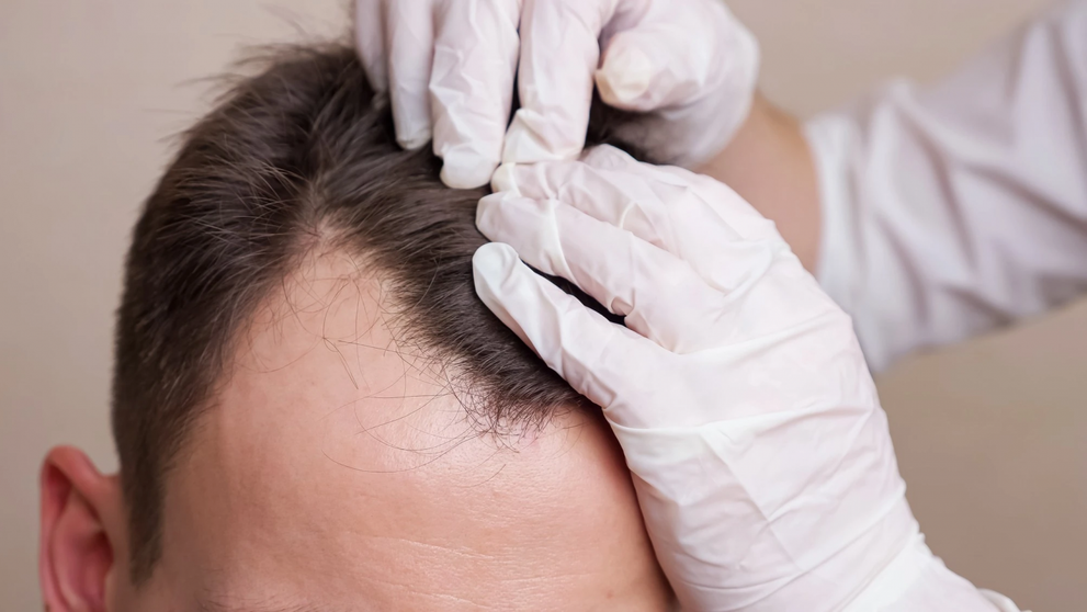 (P) Bucharest Hair Institute te ajută să redobândești părul bogat