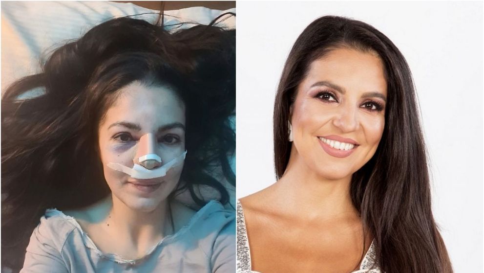 Cristina Joia, a doua operație după ce a fost desfigurată: „Cred că toate lucrurile se întâmplă cu un motiv”