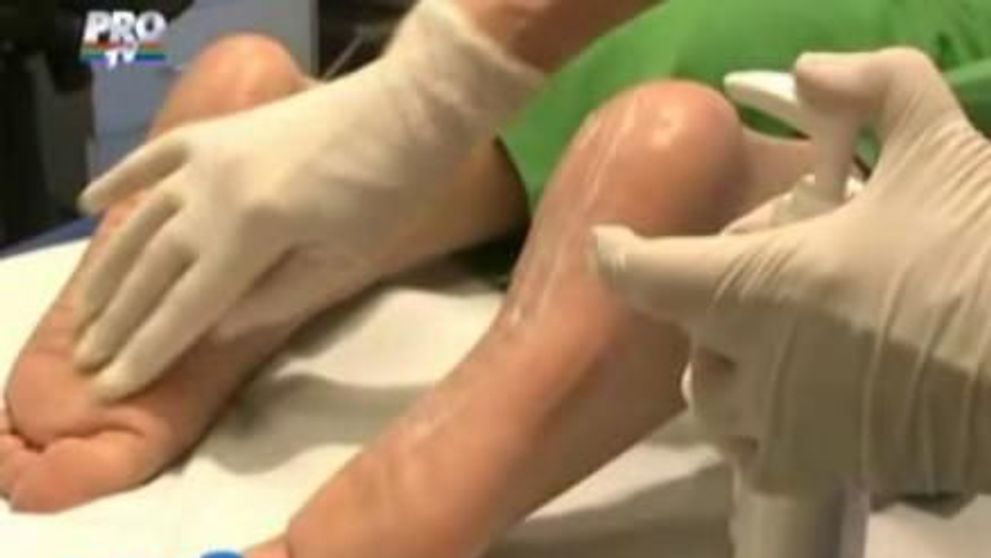 Pielea aspra si crapata de pe calcaie, mai mult decat o problema estetica! VIDEO