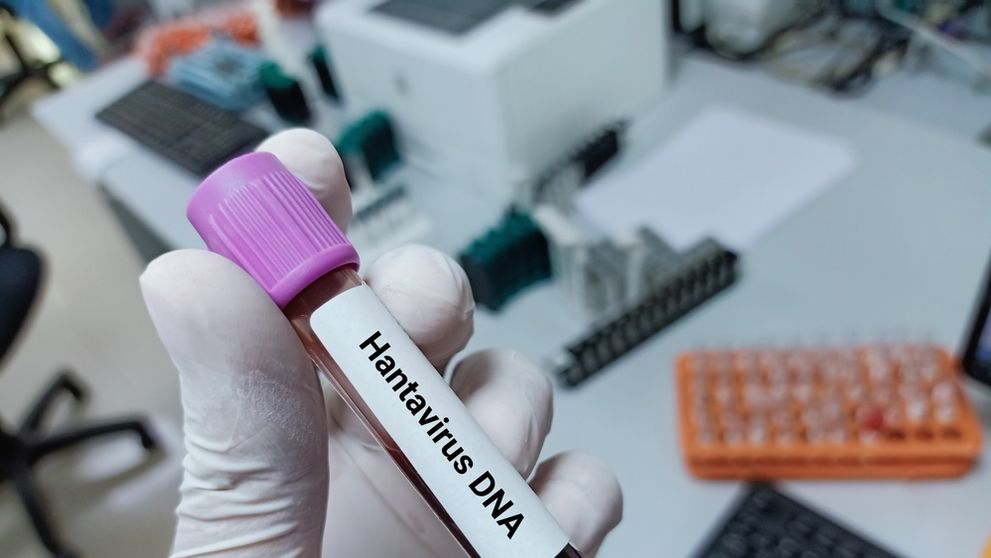 Câte cazuri de Hantavirus s-au înregistrat în România în ultimii ani. Care este riscul de infecție în țara noastră, potrivit INSP