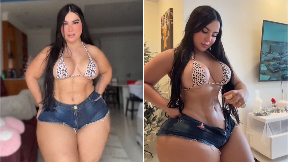 Este supraponderală, dar are abdomen cu pătrățele! Cum a fost posibil: „Chirurgul care te-a făcut așa ar trebui arestat!”