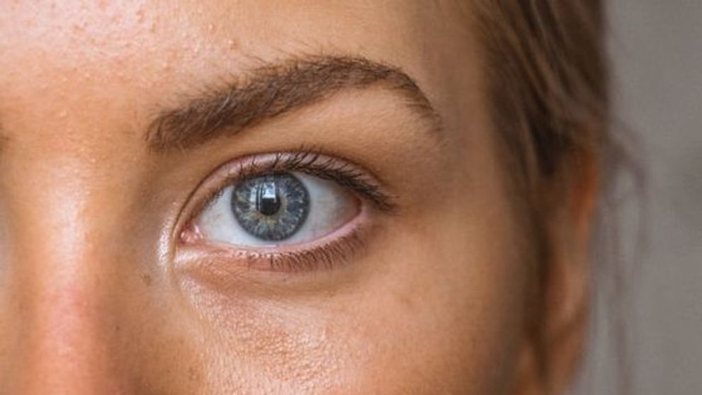 (P) Dermatita atopică, de la cauză la tratament