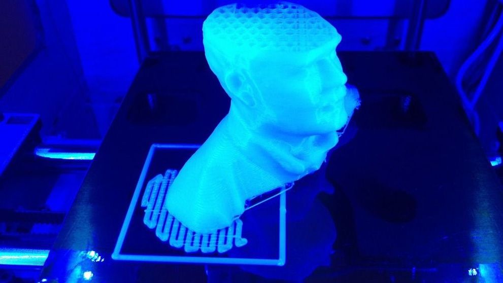 Reconstructia faciala: Rezultate incomparabil mai bune, gratie imprimantelor 3D. FOTO
