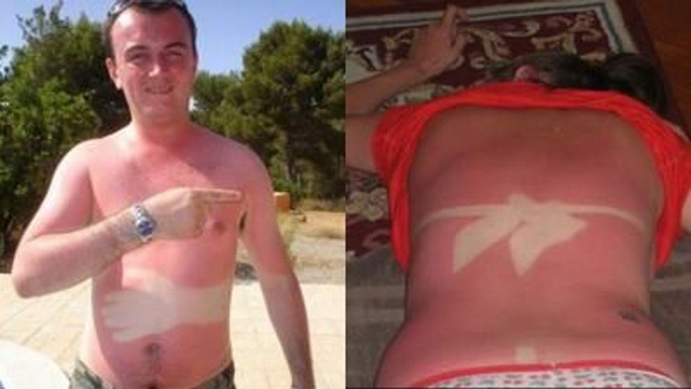 Bronzuri dezastruoase! FOTO