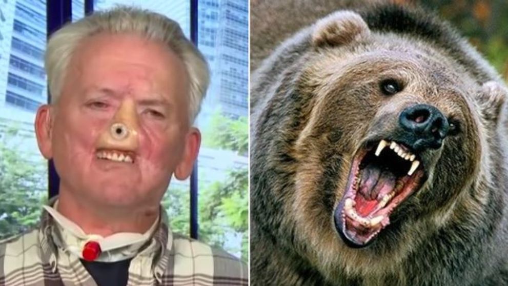 Si-a pierdut nasul dupa o lupta cu un urs Grizzly, iar acum il tine in viata pe brat