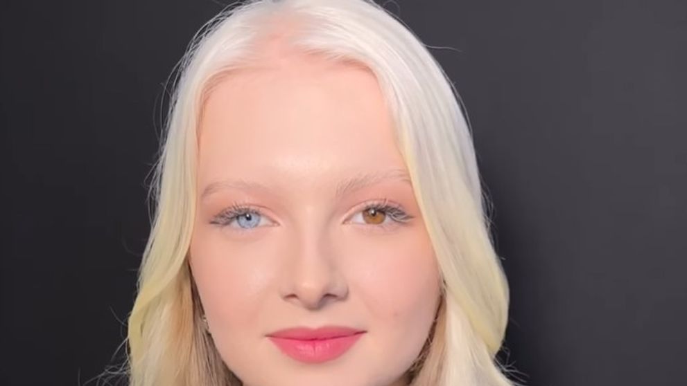 Cum arată Amina la 17 ani, tânăra cu albinism care a uimit lumea cu frumusețea sa nepământeană. Imagini rare alături de mama sa