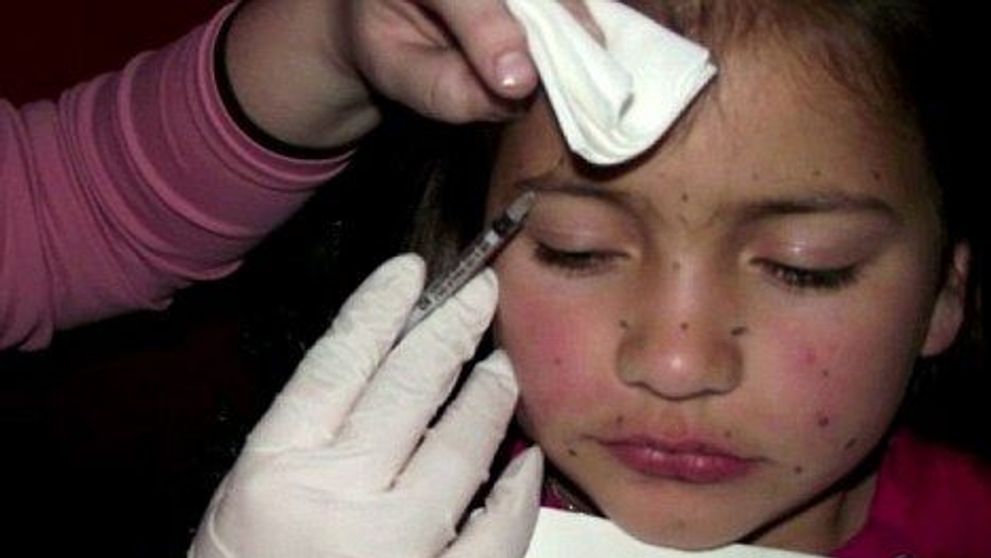 REVOLTATOR: O mama ii face fiicei sale de 8 ani injectii cu BOTOX si o epileaza pe picioare!