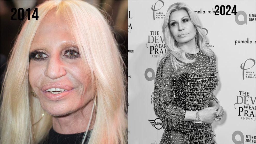 Donatella Versace nu renunță la operații estetice nici la 69 de ani. Fanii, siderați: “Ce și-a mai făcut la față?”