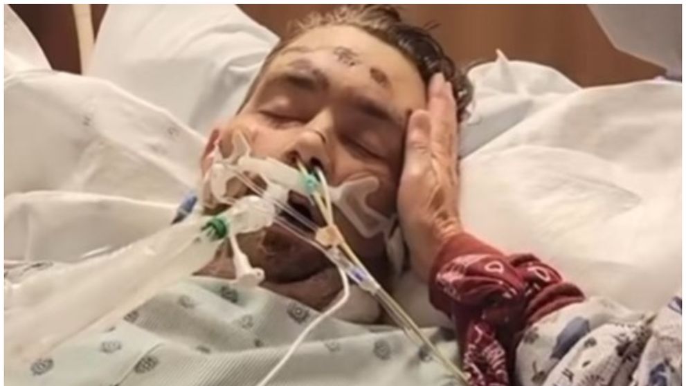Bărbatul care a intrat în comă după ce a încercat să scoată un fir de păr crescut sub piele s-a recuperat. Familia vorbește despre un miracol