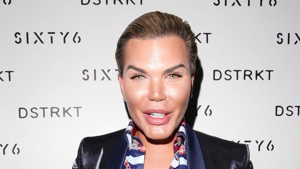 Decizie uimitoare pentru Rodrigo Alves. Are interzis la liposuctii, dar vrea sa faca asta: 
