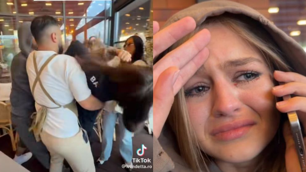 „Comoție cerebrală post-traumatică de formă…”. Care este starea Anei Beregoi după ce s-a bătut cu Andreea Bostănică. Primele declarații ale medicului care a consultat-o