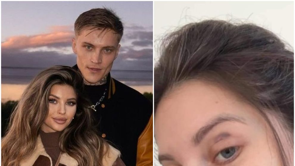 Valerie Lungu a apărut cu ochiul vânăt pe internet. Celebra influenceriță a povestit ce a pățit, iar fanii au avut un șoc. Ce s-a întâmplat