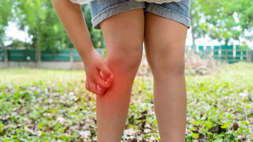 Primul caz de infecţie cu virusul West Nile din acest sezon, confirmat în Bucureşti. Au început tratamentele suplimentare de combatere a ţânţarilor