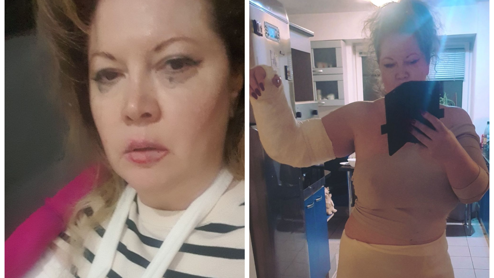 Oana Lis a ajuns de urgență la spital: 