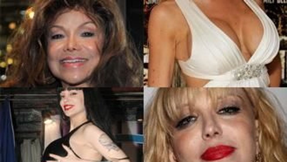 Victimele frumusetii artificiale. Ele sunt celebritatile cu operatii estetice dezastruoase - FOTO