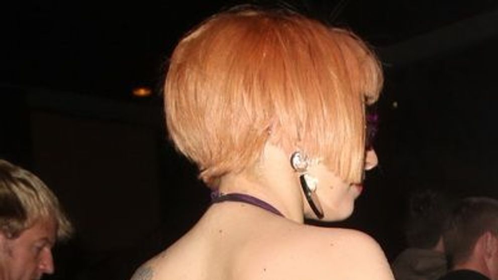 Lady Gaga, cu fata tumefiata dupa accidentul de pe scena. Vezi cum arata dupa ce i-a cazut o bara metalica in cap - FOTO
