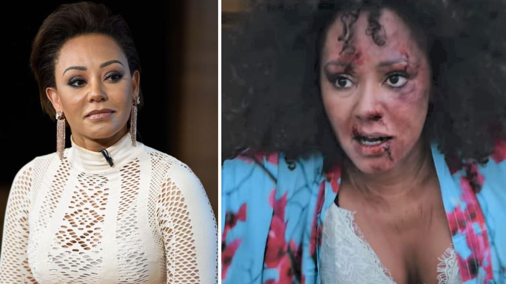 Mel B, desfigurată și plină de vânătăi într-un clip de promovare a luptei împotriva violenței domestice