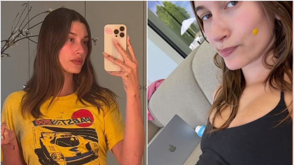 Pare însărcinată, dar, de fapt, suferă de o problemă gravă de sănătate. Dezvăluirea care i-a întristat pe fanii lui Hailey Bieber