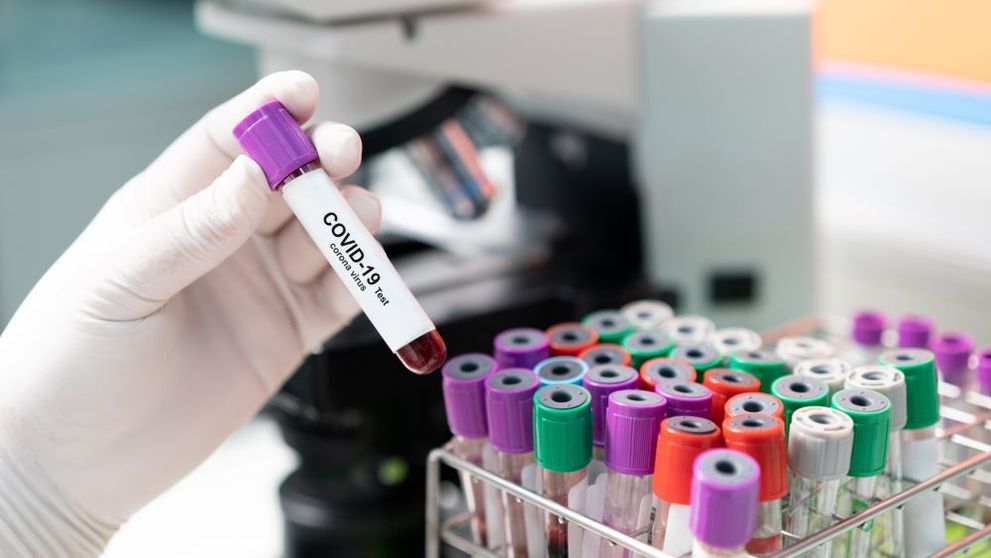 Noi descoperiri despre coronavirus. Ce probleme produce la nivelul sistemului nervos