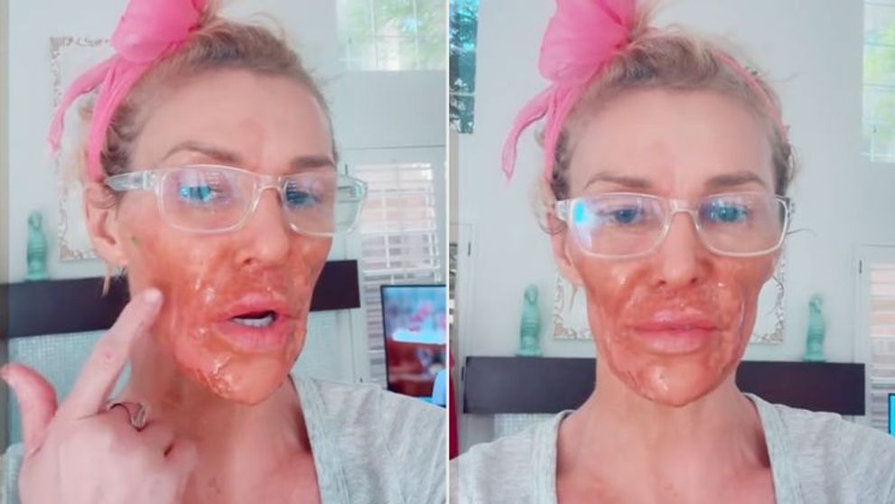 Ce se întâmplă cu fața lui Brandi Glanville. Vedeta este desfigurată și crede că un parazit îi distruge chipul: „Arăt ca un monstru”