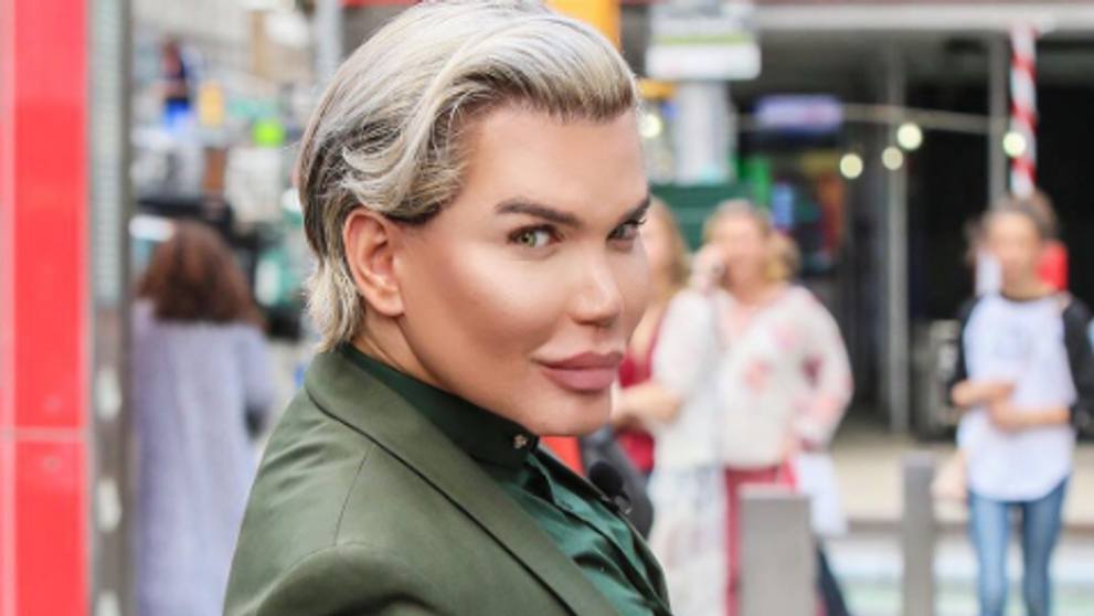 Are 57 de operatii estetice, dar nu se opreste aici. La ce procedura va recurge Rodrigo Alves