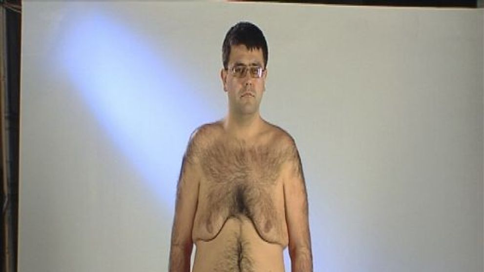 Un tanar de 30 de ani a suferit o transformare uluitoare
la ”Frumusete pe muchie de cutit”