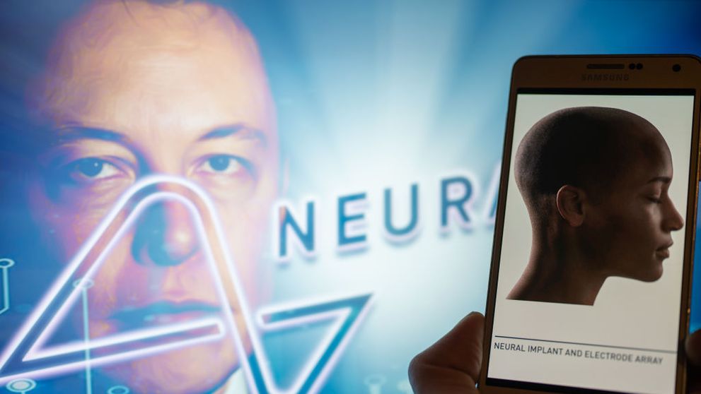 Neuralink, compania lui Elon Musk, a implantat primul cip în creierul unui om. Internauții sunt terifiați: „S-a născut primul cyborg!”