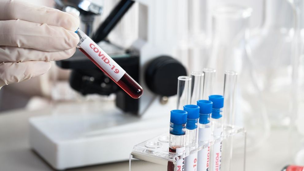 De ce ies unele teste de coronavirus fals pozitive. Explicația incredibilă a autorităților
