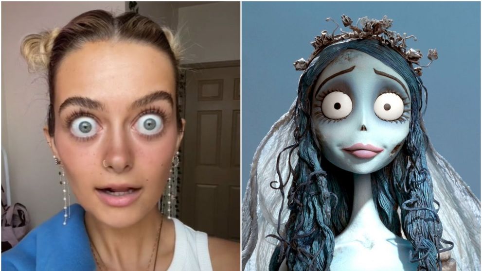 O tânără a devenit virală pe TikTok datorită ochilor ei bulbucați: 