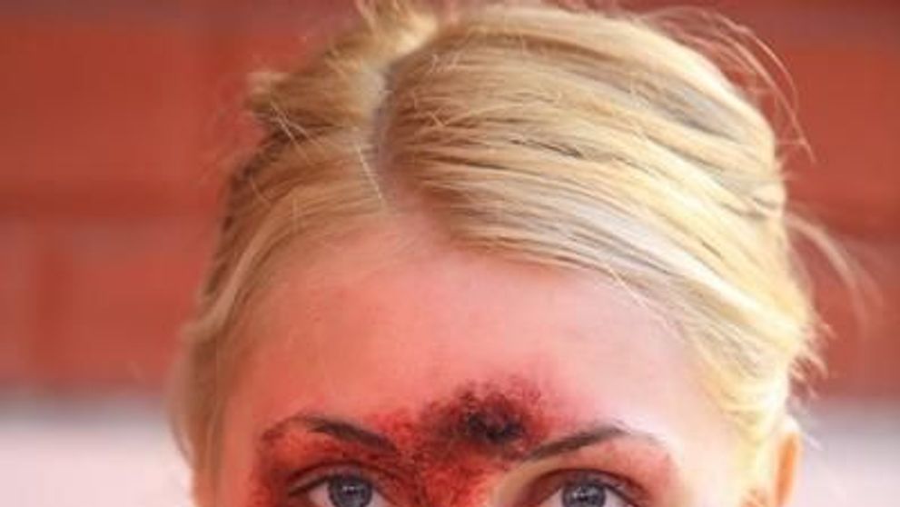 Andreea Patrascu, cu chipul desfigurat in “Iubire si onoare” - FOTO