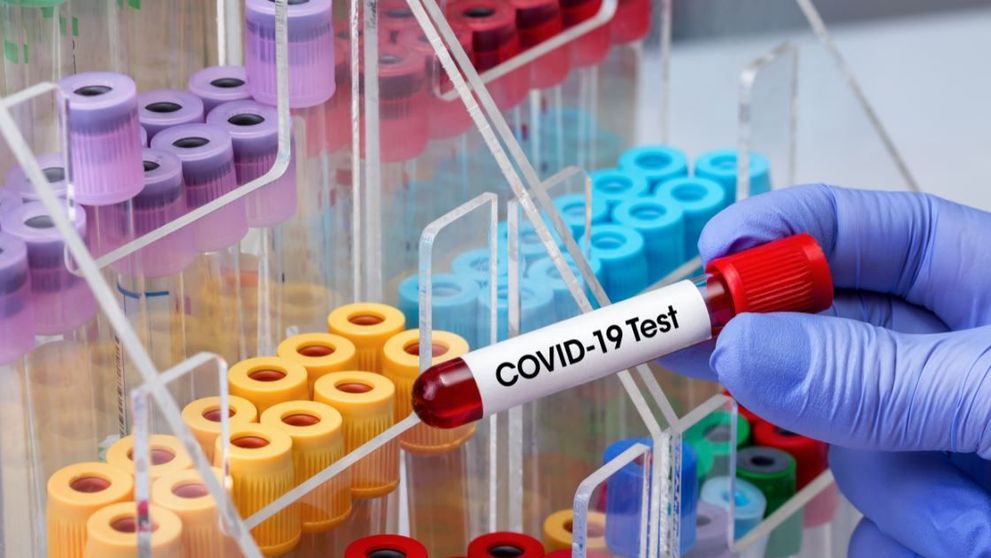 Un epidemiolog de top al OMS a vorbit în mod oficial despre rata deceselor cauzate până acum de noul coronavirus
