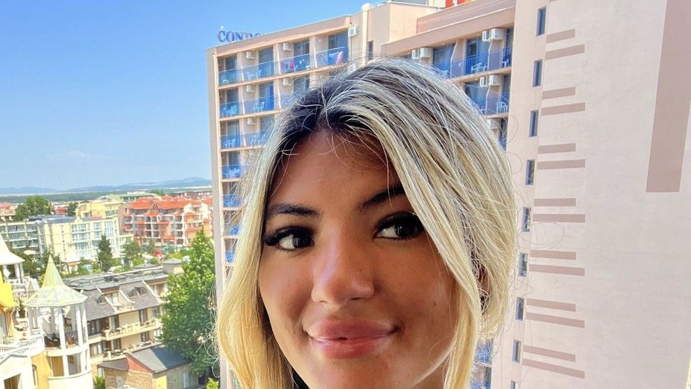 Ce a pățit o tânără după ce a adormit pe o plajă din Bulgaria! Aspectul ei fizic a avut de suferit