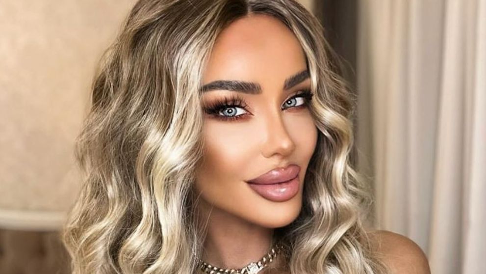 Bianca Drăgușanu a renunțat la cagulă. Cum arată fosta prezentatoare, după operația de lifting : „Mi-am revenit spectaculos”