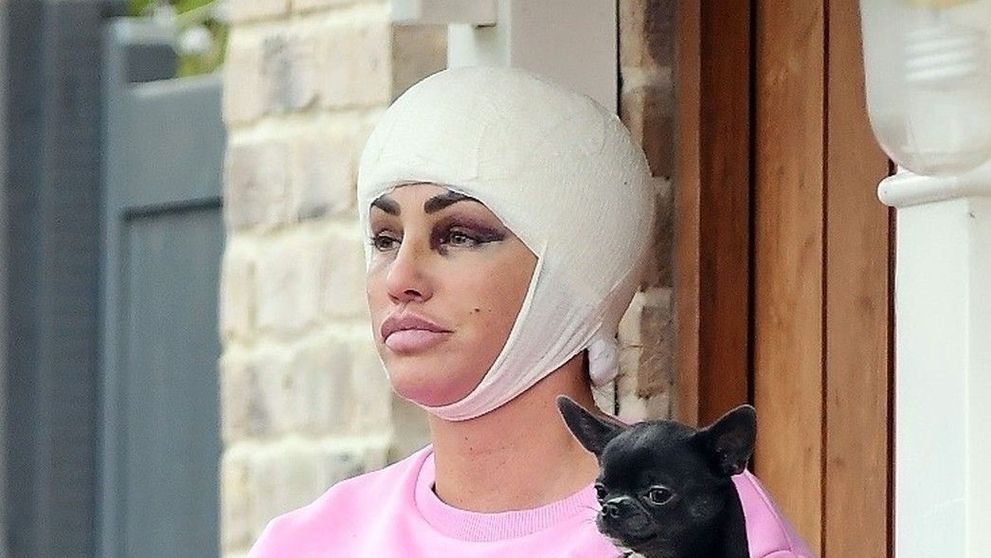 Katie Price, surprinsă cu bandaje și cu fața tumefiată după o nouă operație estetică