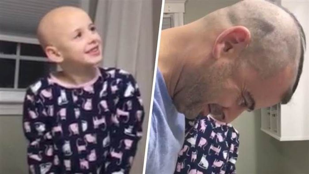 Si-a dorit ca fiica lui sa se simta frumoasa, desi sufera de alopecie. Ce a facut acest tatic merita tot respectul