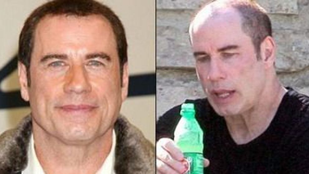 Cum se darama mitul unei super vedete: transfomarea ciudata a lui John Travolta