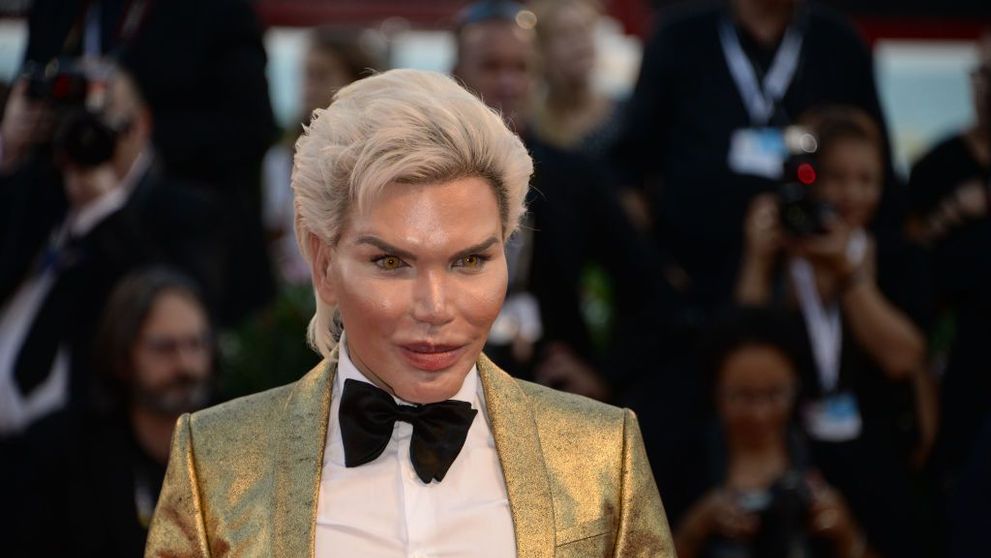 Decizia pe care Rodrigo Alves a luat-o cu privire la tranziția în femeie. Ce a hotărât vedeta