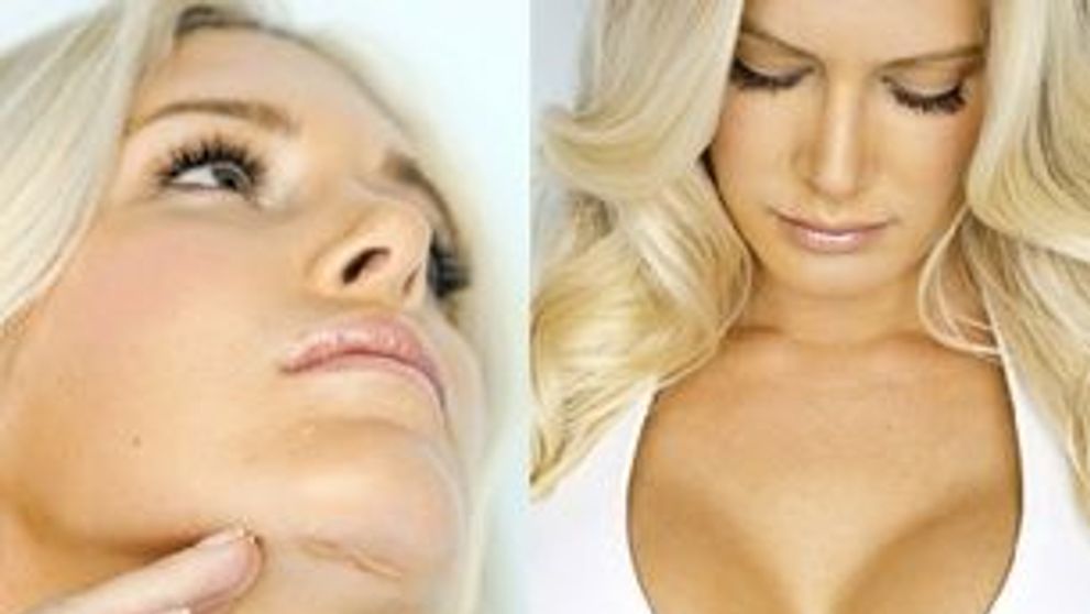 Heidi Montag isi arata cicatricile! FOTO  