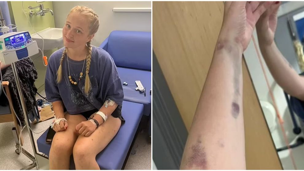 „Am cancer în stadiul patru și am aflat abia după ce...”. Această tânără de 24 de ani a ignorat o serie de simptome ciudate. Ce a simțit înainte de a-i fi pus diagnosticul
