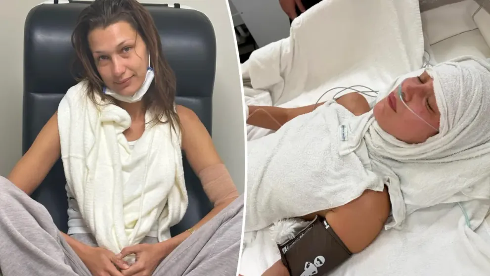 Bella Hadid, din nou în spital. Mărturisiri dureroase despre efectele bolii Lyme asupra sănătății ei. Imagini îngrijorătoare cu vedeta